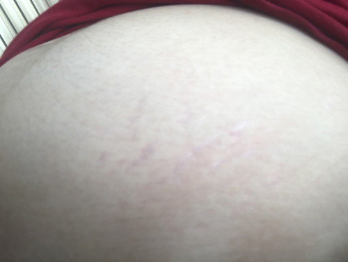 ถามแม่ๆหน่อยค่ะขออนุญาตค่ะ