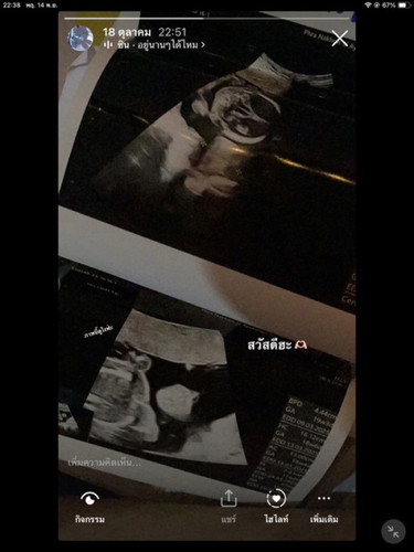 วันเกิดจริง ที่ไม่ได้เกิดขึ้นจริง