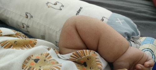 Ini biang keringet atau apa ya bun?