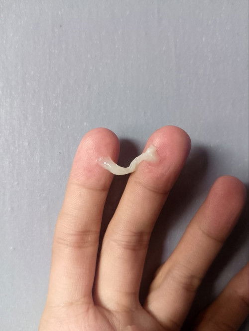 MUCUS PLUG NA BA? 37weeks&3Days