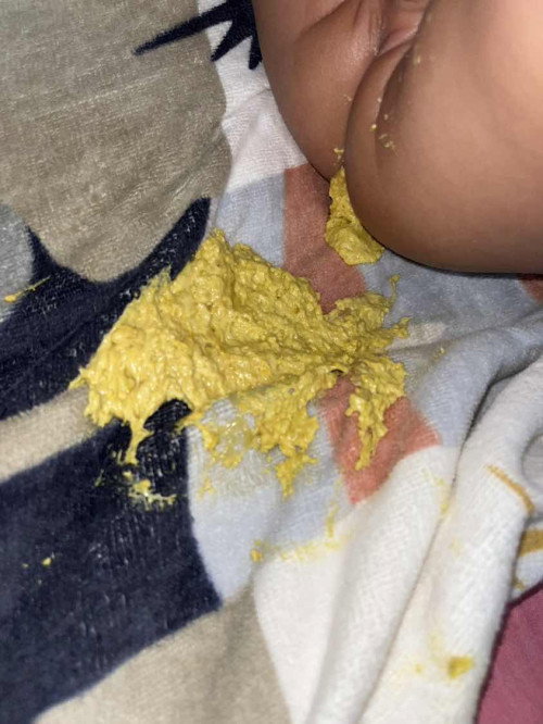 Warna bab bayi sufor