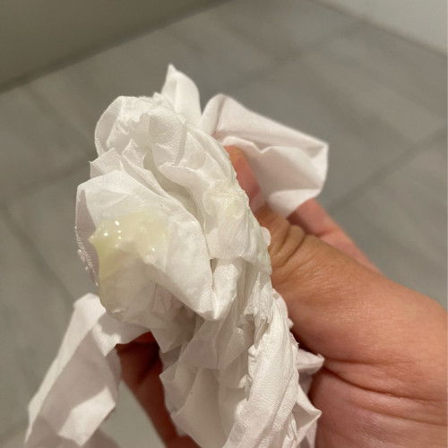 แบบนี้คือมูกหรือตกขาวคะ