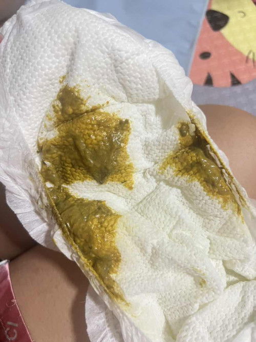 น้องอึแบบนี้ปกติไหมคะ อายุ8เดือนจ้า