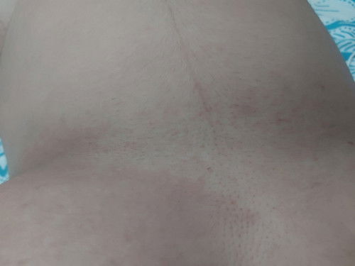 สอบถามแม่ๆตั้งครรภ์หน่อยค่ะ