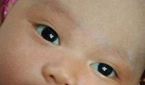 Bayi 2 bulan matanya belom jernih