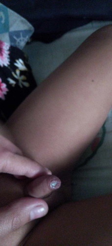 Mga Mammy ask ko lang po.Ano po kaya tong lumalabas sa private part ng baby ko.Turning 2 na po siya.