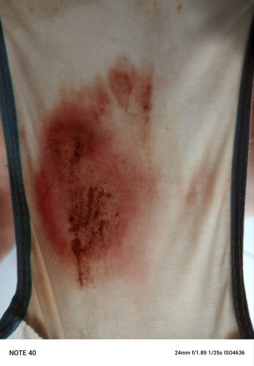 Usia 30 week keluar darah