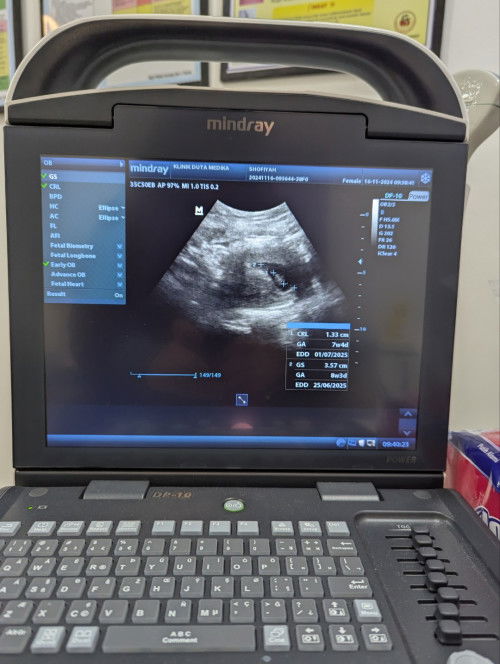 ❤️❤️ USG pertama