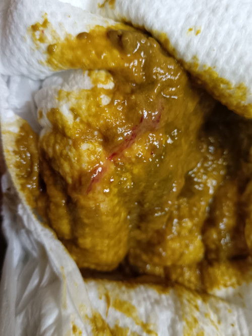 may dugo sa poop ni baby