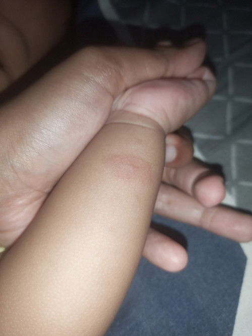 bayi umur 7 bulan tiba tiba muncul kayak gini