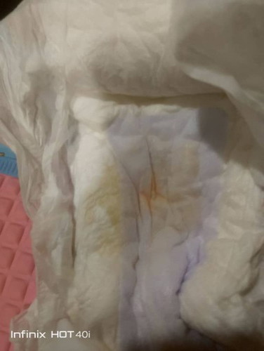 Anak 5 bulan 25 hari kencing oren