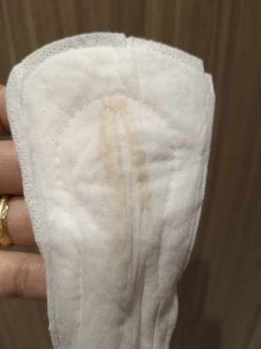 Yellow discharge po ba eto? 21 weeks po ako.