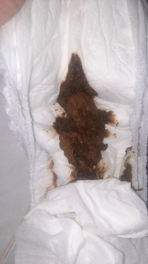 Maaf jorok ini foto pup bagi yg tidak mau liat atau ditanya langsung skip saja