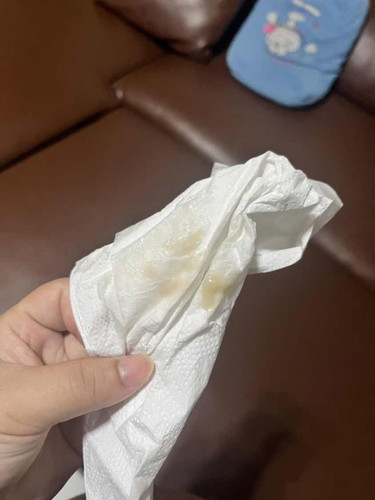 มีมูกไหลออกมา ตอน38+2week