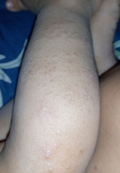 Is this allergy or what?