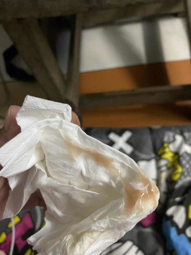 แบบนี้ต้องไปรพ.ไหมคะ