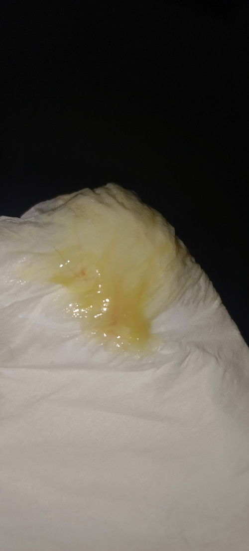 40weeks keluar lendir sudah 3 hari berturut