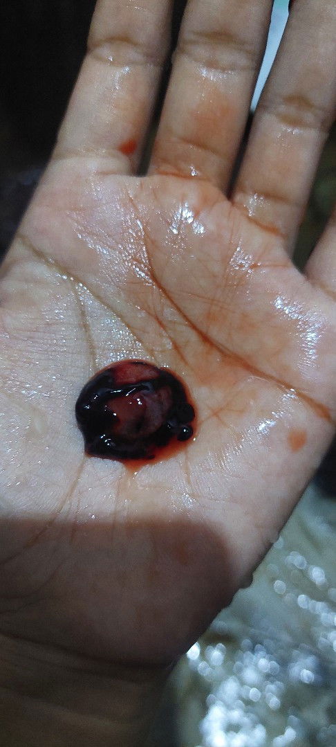 Bun Liat sini dong!!!!!!!