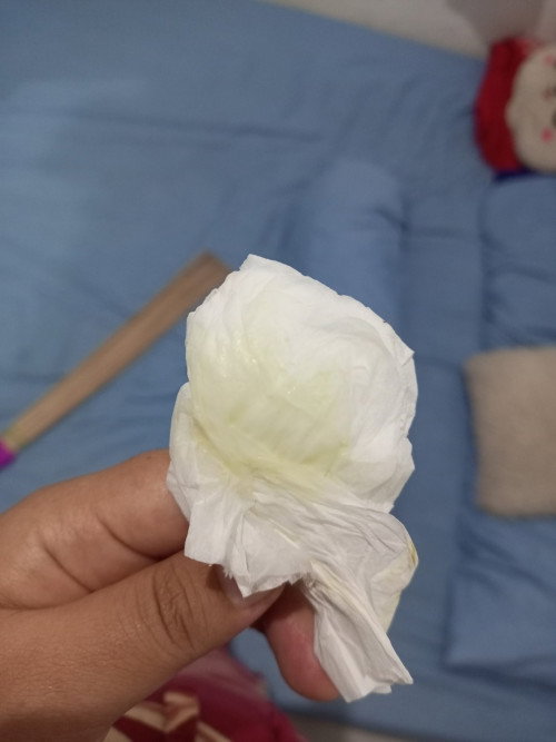 Kalo kluar cairan kaya gini tanda2 udah mau melahirkan apa belum ya Bun, soalnya perut kenceng2