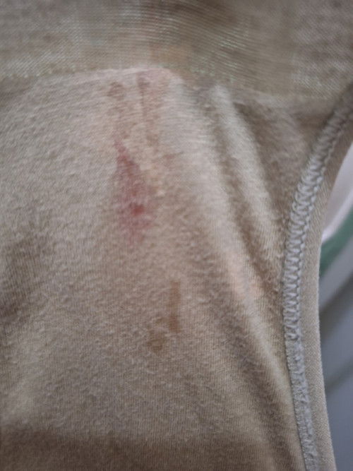 Maaf kalo jorok. Ini darah apa keputihan yaa?? Aku baru seminggu kelar nifas. Masa udh haid lagi??