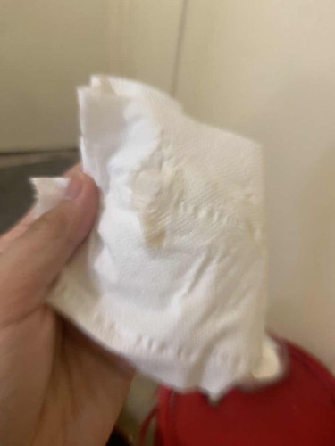 Light brown discharge