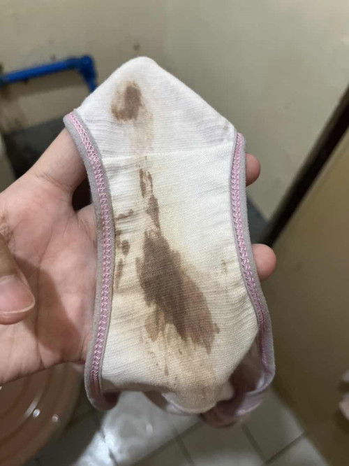 Normal ba ganito discharge