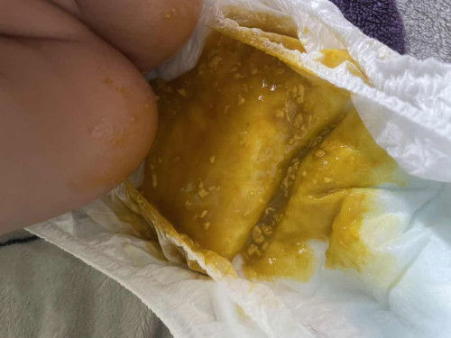 Normal atau tak ye ?