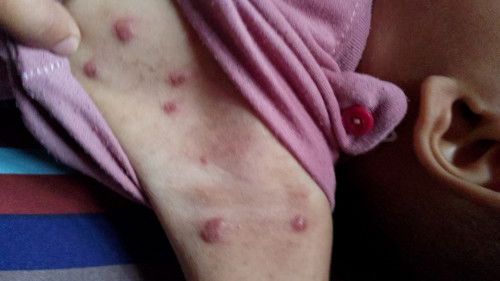 Kira kira ada yang tau gak obatny