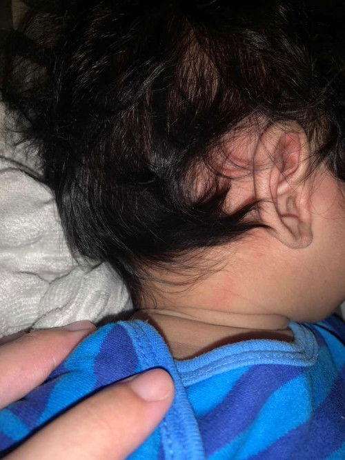 หัวลูกเป็นแบบนี้เกิดจากอะไรคะ