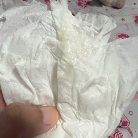 ใช่สัญญาณเตือนคลอดมั้ยคะ