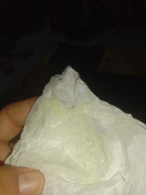 ตกขาวสีเหลือง