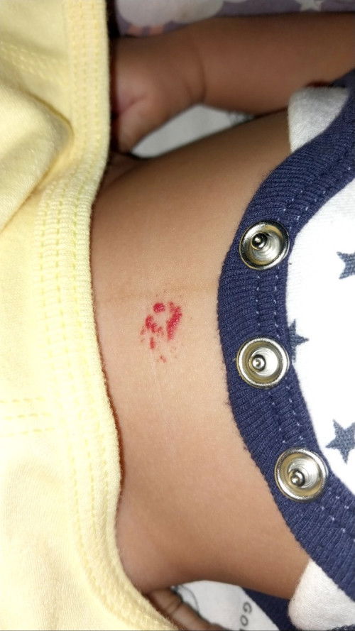 Bayi usia 1bulan 20 hari