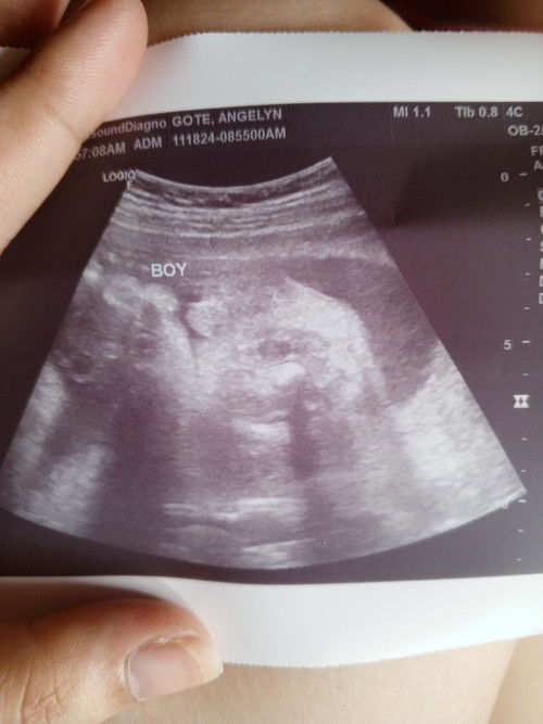 Mga momshie tanong ko lang po pano nalalaman at saan banda yung gender ni baby?