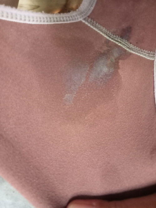 Ketuban rembes bukan ya