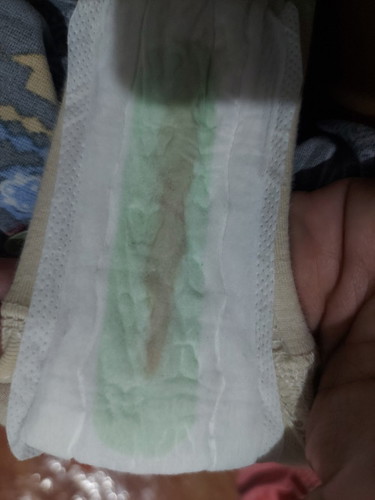 36weeks Brown Discharge