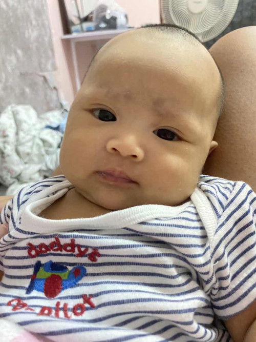 ทารกอึเหลว มีลักษณะแบบไหนหรอคะ