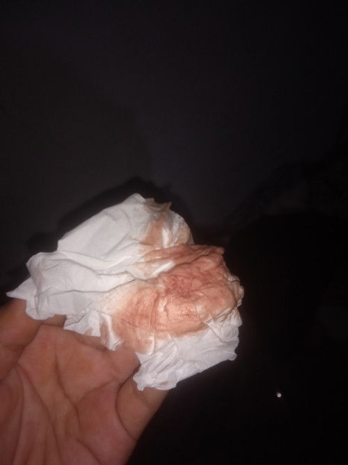 Keluar darah usia kehamilan 40 minggu