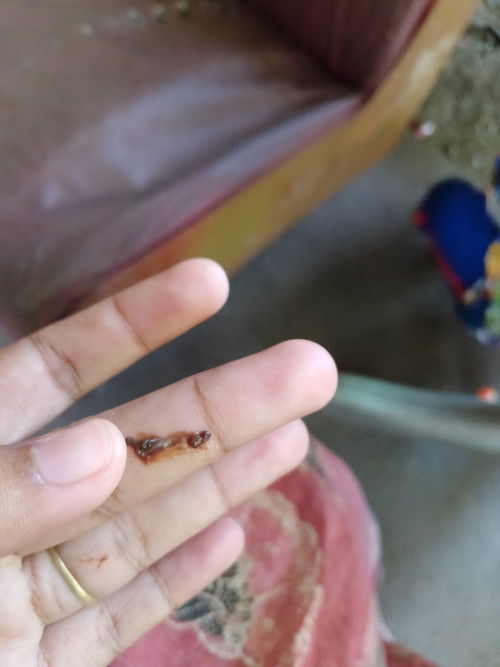 มีมูกออกแบบนี้ มีปวดเหมือนจะอึ ปวดแปปหายๆ 38+5 ควรไปโรงพยาบาลไหมคะ