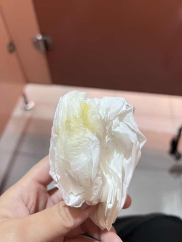 37Wมีมูกสีเหลือง