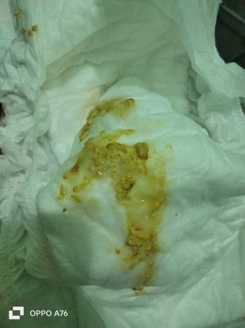 Tanyak Seputar Pup Bayii