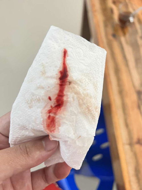 #มูกเลือดขณะตั้งครรภ์