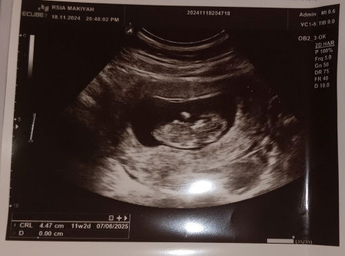 Kapok priksa ke puskesmas,