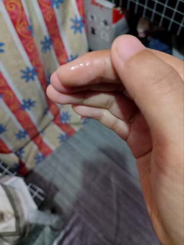 Eggwhite??