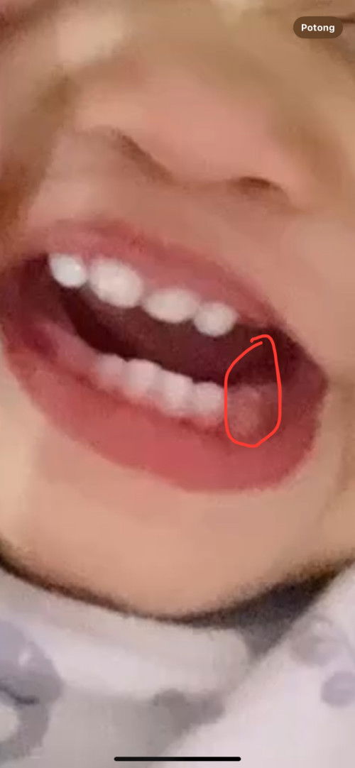 Gusi anak berwarna putih