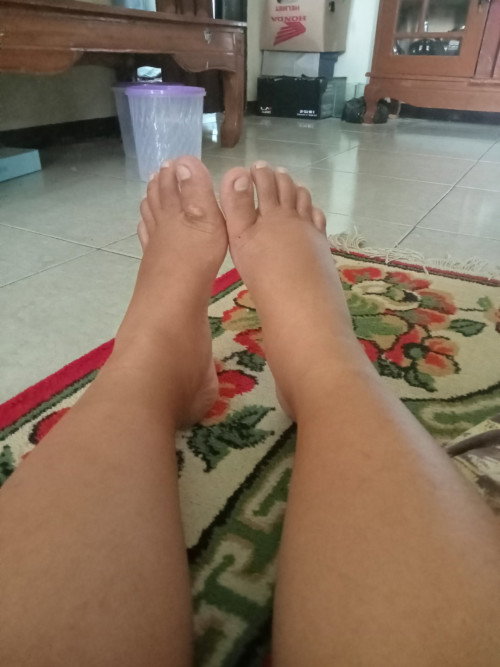 Kaki bengkak 36 weeks