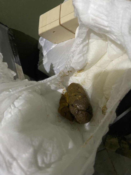 PUP BAYI 11 BULAN besar dan keras apakah aman. maaf foto pup🙏‼️