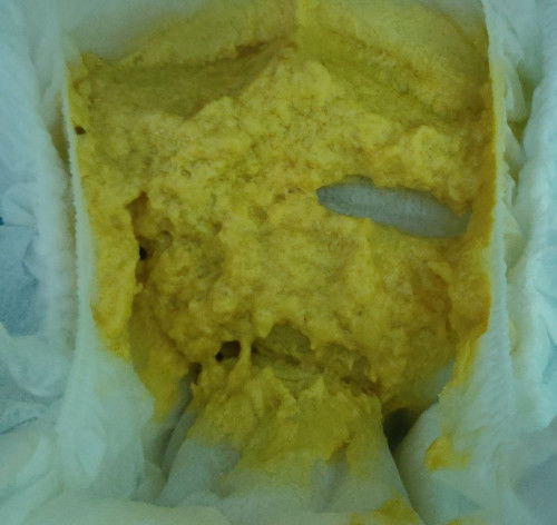 Adakah normal najis bayi saya?