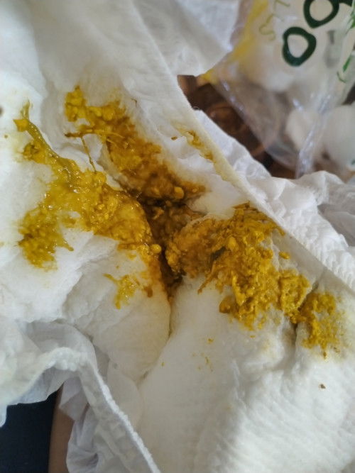 Normal lg po ba tong poop ni baby? Sinisipon po kasi siya at medyo inuubo.