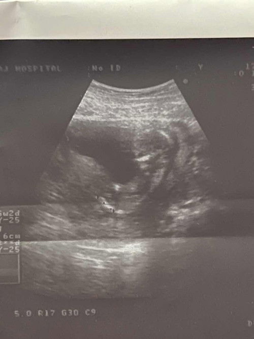 สอบถามแม่ๆหน่อยค่ะ ว่าดูเพศกันยังไง