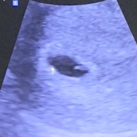 ซาวด์เจอน้องเเละหัวใจน้องตอนกี่วีคค่ะ